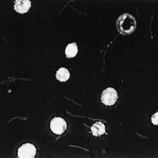 Spirochete-like cells in blood cultures as seen by dark- fi eld ...