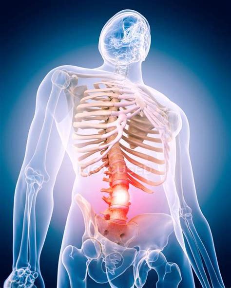 Spinal pain causes — computer artwork, spine - Stock Photo | #160559578