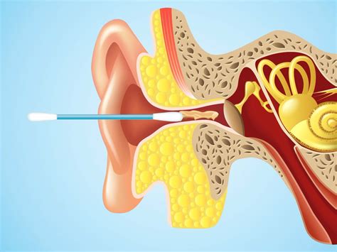 WATCH:Here’s why you should never put Q-Tips in your ears | Cleaning ...