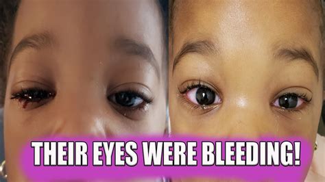 THEIR EYES WERE BLEEDING! | VLOG - YouTube