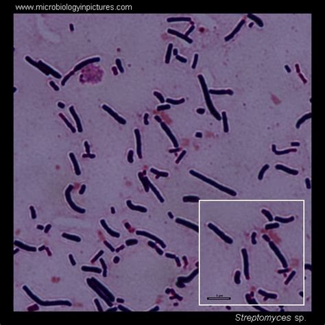 Streptomyces Gram Stain