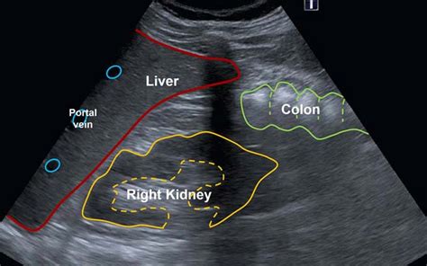 Abdomen anatomy - Radiology Cafe