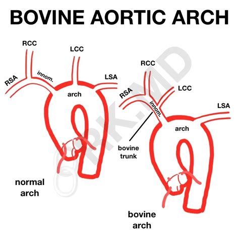 Arteries Of The Aortic Arch