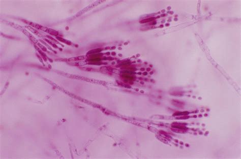 Penicillium Sp. Conidia Lm #1 Photograph by Michael Abbey - Fine Art America