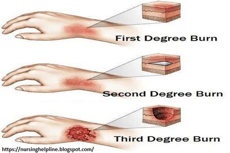 Trauma – USC EMSC