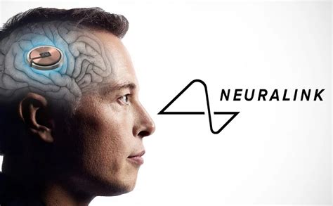 Khoa học/Công nghệ - Công ty cấy ghép não của Elon Musk - Neuralink đã ...