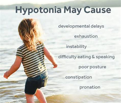 These are the following which Hypotonia may cause - MEDizzy