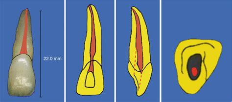 Anatomy and Root Canal Morphology | Pocket Dentistry