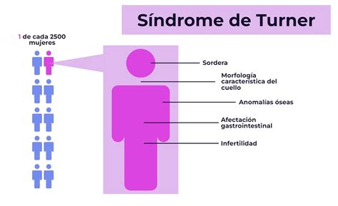 Síndrome de Turner: ¿Qué es y cómo se diagnostica? - Genotipia