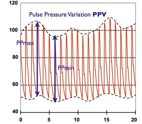 Difference Between Pulse and Pulse Pressure | Compare the Difference Between Similar Terms