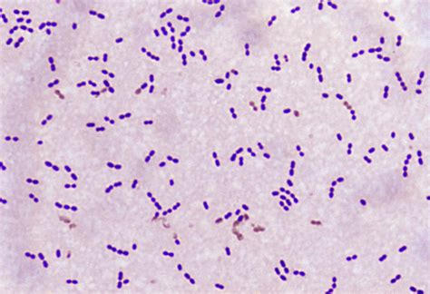 Streptococcus Bacteria Gram Stain