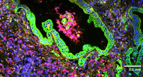 CosMx SMI Overview - Single-Cell Imaging - NanoString