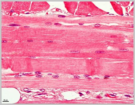 Skeletal Muscle Chart | sexiezpix Web Porn