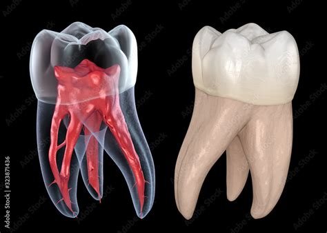 Maxillary Nd Molar Root Canal Anatomy | sexiezpix Web Porn