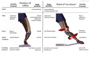 MCL Sprains Part 2 - Treatment, Rehab & Prevention | POGO Physio Gold Coast