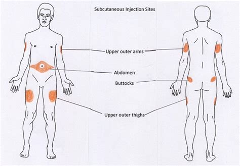 7.4 Subcutaneous Injections – Clinical Procedures for Safer Patient Care