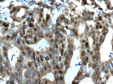 P53 Rabbit anti-Human, Mouse, Rat, Polyclonal, Proteintech:Antibodies:Primary | Fisher Scientific