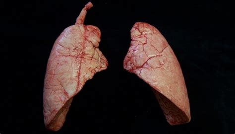 Por primera vez científicos crean pulmones humanos en el laboratorio