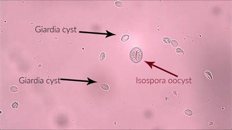 Giardia cysts and Isospora oocyst (canine) - YouTube