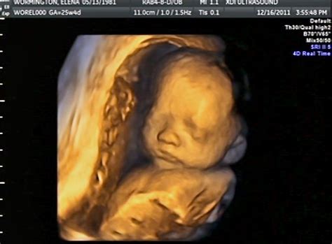 Our Little Worm: 25 weeks 3d ultrasound!