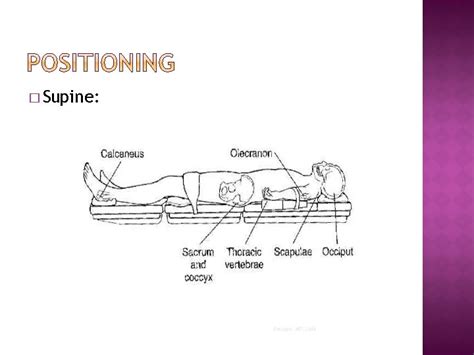 Basic Positions Supine Lithotomy Sitting Prone Lateral Complications