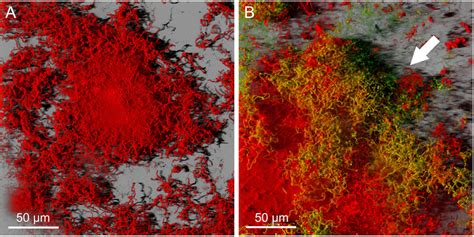 Three-dimensional reconstructed images of S. mutans biofilm stained ...