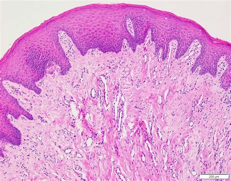 Histology Of The Oral Mucosa Histology And Embryology