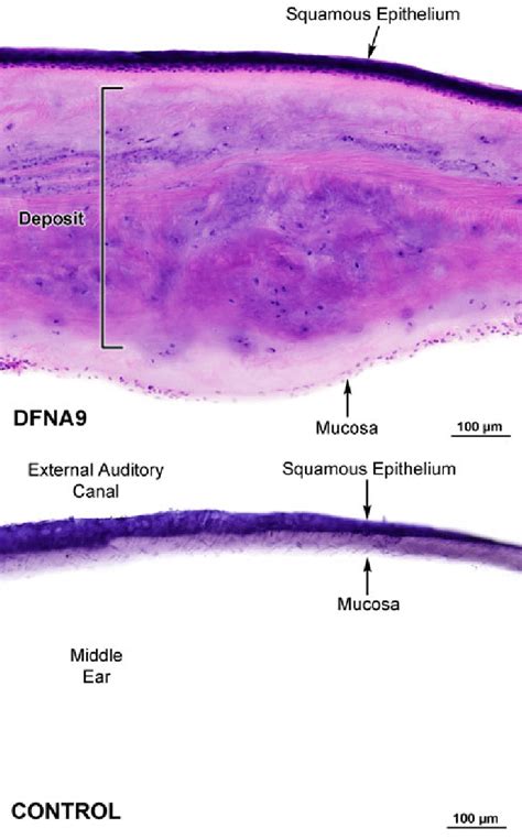 Tympanic Membrane Layers