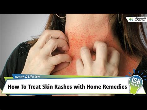 Common Face Rash Causes and Treatment, face on - mi-pro.co.uk