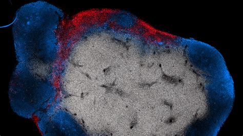 Spotlight: Boosting T cell therapy | MIT - Massachusetts Institute of Technology