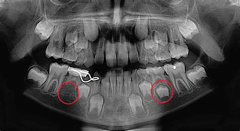 Changing smiles are normal and beautiful! — Lakes Region Dental Center