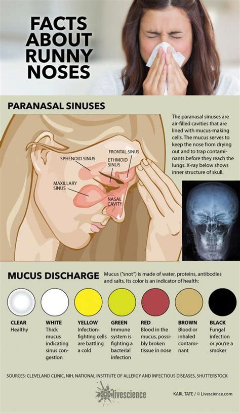 Diagram of sinuses and chart of mucus colors. #HealthCareTips in 2020 | Mucus color, Sinusitis ...