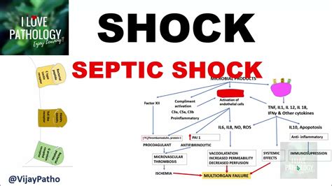 SHOCK: Types, Pathogenesis of Septic Shock - YouTube