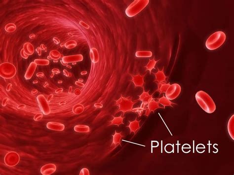 High Platelet Count | MedGuidance