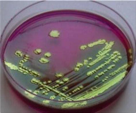 Escherichia coli: An Overview of Main Characteristics | IntechOpen