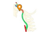 Foramen lacerum - e-Anatomy - IMAIOS