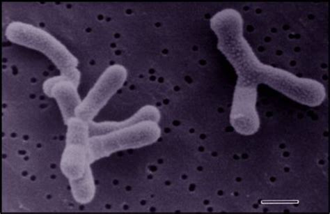 Bifidobacterium - microbewiki