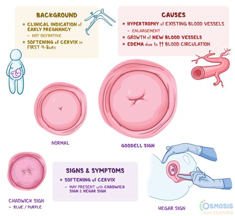 Goodell Sign: What Is It, Causes, Findings | Osmosis