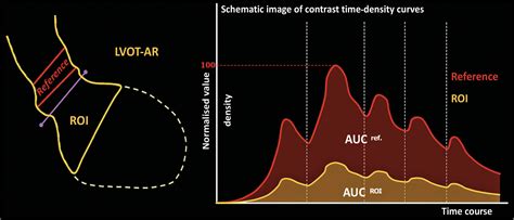 Quantitative aortography for assessing aortic regurgitation after transcatheter aortic valve ...