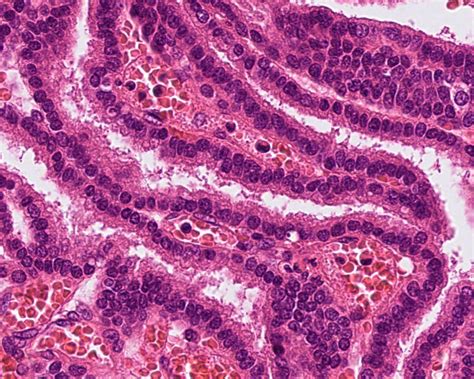 Choroid Plexus Histology