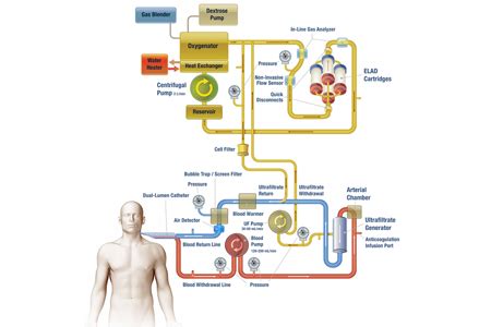 “Bio-Artificial Liver” Begins Clinical Testing