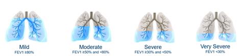 COPD Stages - COPD info