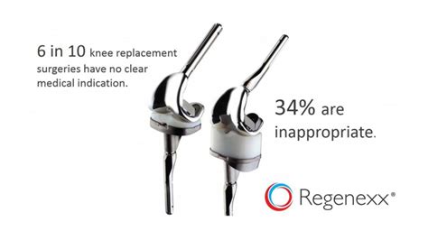 1/3 of Knee Replacements Unnecessary…Why Are They Performing Those ...