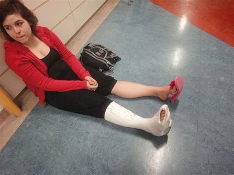 castgirls: webfinds: broken toe casts