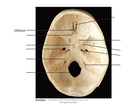 Fig. 9.10 Superior view of floor of cranial cavity Diagram | Quizlet