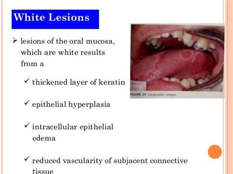 White lesions (2)