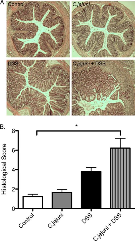 C. jejuni infection increases the severity of histological inflammation ...