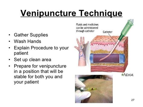 Venipuncture Technique Gather Supplies Wash Hands Explain Procedure to your pa...