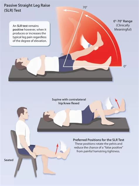 Straight Leg Raise Test - SLR test - Mobile Physio