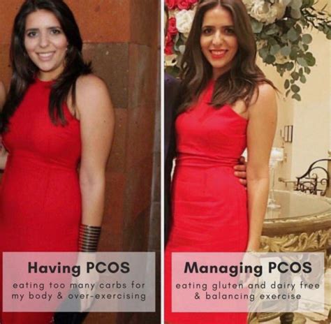 3-Steps to PCOS Weight Loss - PCOS Weightloss